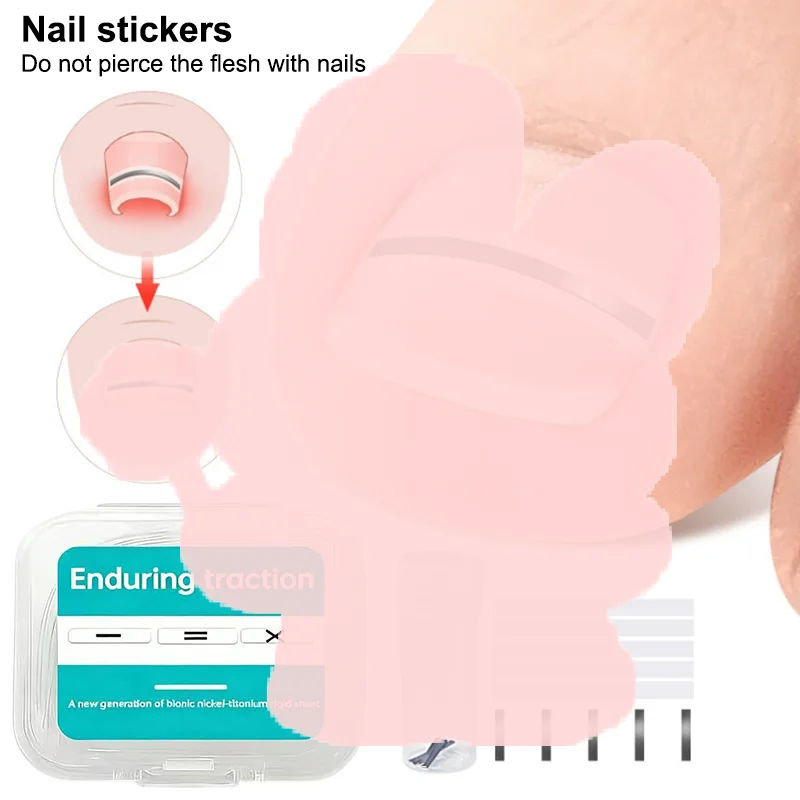 Strumento per la protezione delle dita dei piedi per la correzione dell'unghia del piede incarnita Adesivo per il trattamento delle unghie Strumento per pedicure della paronichia