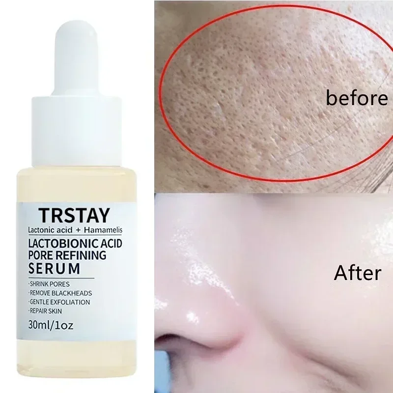 Suero Facial que encoge los poros, elimina los poros grandes, reafirmante, limpieza Facial profunda, minimiza la purificación, blanquea el cuidado de la piel