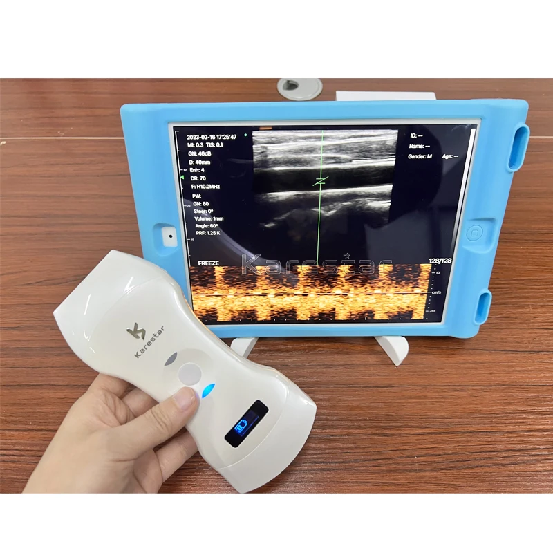 Karestar 3 In 1 Smart Phone Mobile Vet Ultrasound Scanner Wireless Pocket Ultrasound Machine For Android/IOS