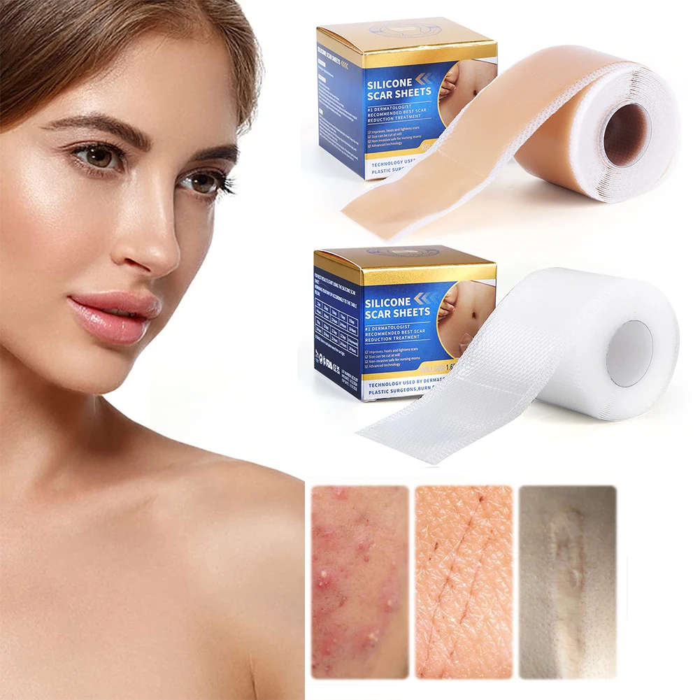 

Силиконовая лента для удаления шрамов телесного цвета, 1 рулон, безболезненная секция, келоидная хирургия, лист для удаления шрамов, эффективная лента для уменьшения шрамов