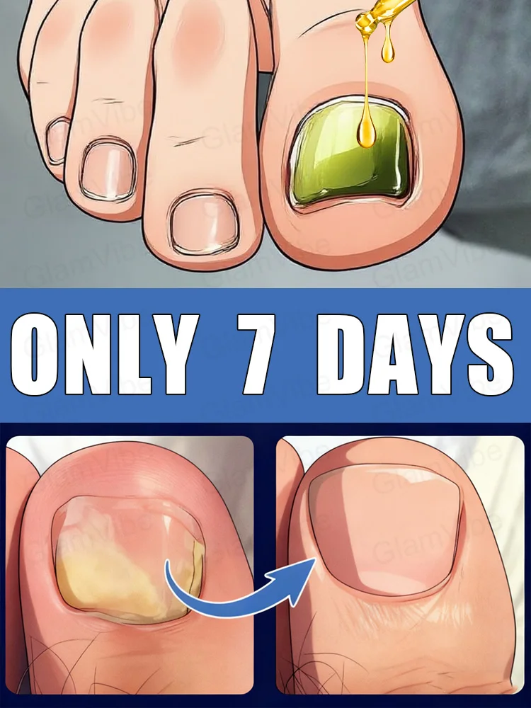 uick TreatmentAddio ai preoccupazioni fungali delle unghie Spazzola per la pulizia delle unghie di vendita calda