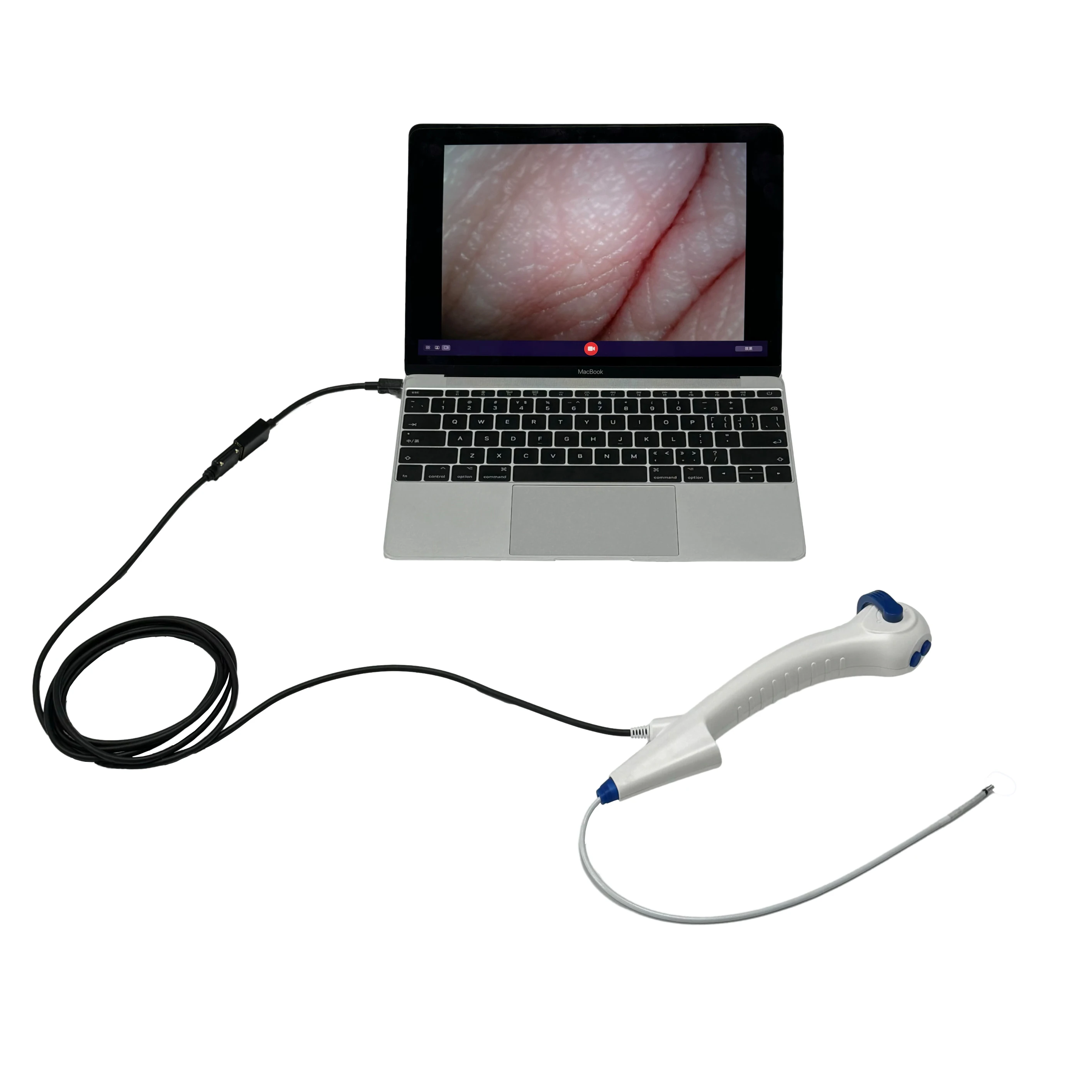 Sensorendo single use flexible video laryngoscope/rhinolaryngoscope with USB cable Mega pixel lens for intubation/ENT