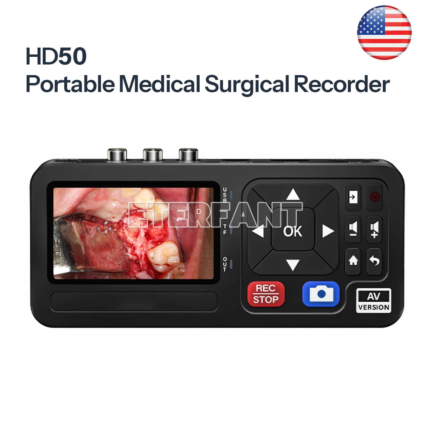 

ETERFANT Portable Medical Surgical Recorder for Laparoscopy and Endoscopy Capture HD50 3-inch Large Screen Preview