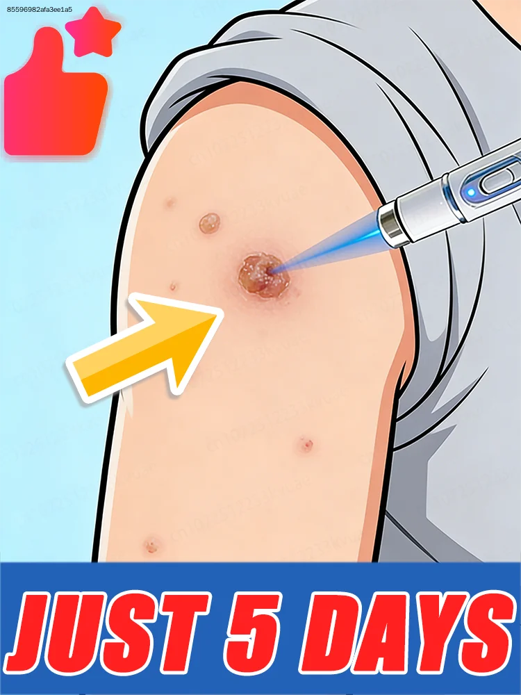 

Лазерная ручка-указатель для удаления бородавок, подходит для ежедневного использования. Новейшая и самая продаваемая модель.