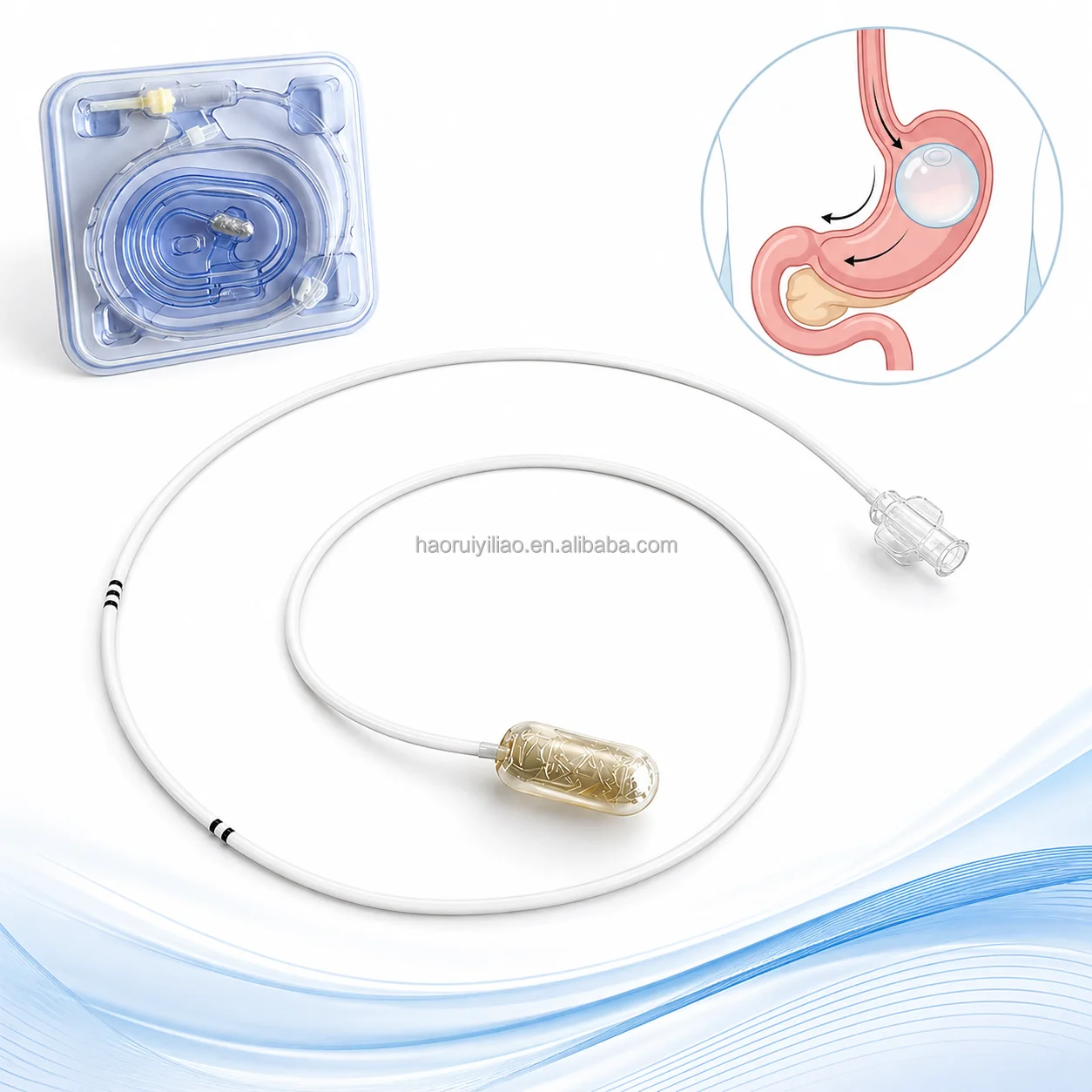 Non-Surgical Swallowable Gastric Balloon for Weight Loss Endoscopy-Free Intragastric Balloon