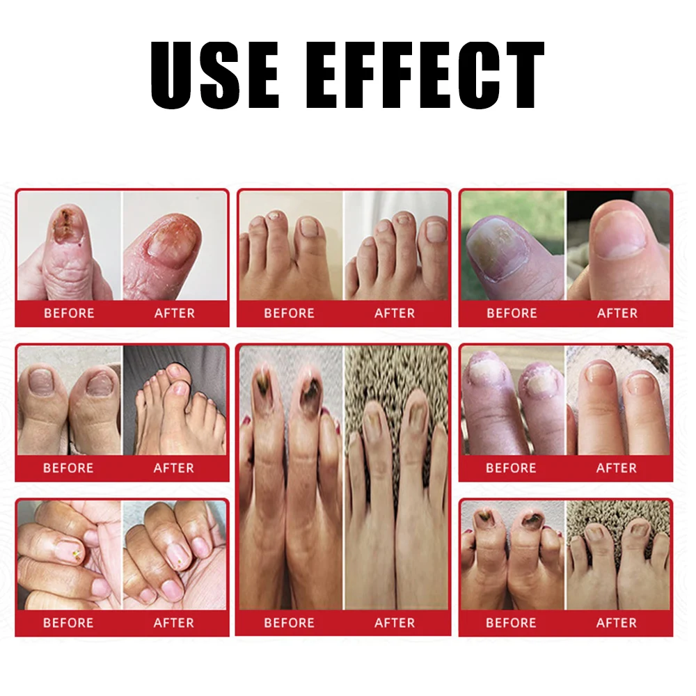 جديد إصلاح فطار الأظافر جوهر المياه المكونات الطبيعية النقية العناية بالأظافر للمنزل والجمال #3