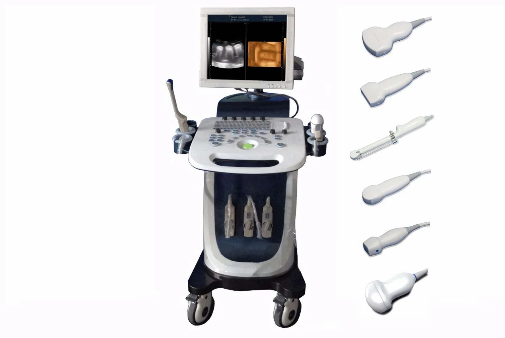 Superior Quality XF7800 Plus Full Digital Color Doppler System Color Mobile Device Ultrasound