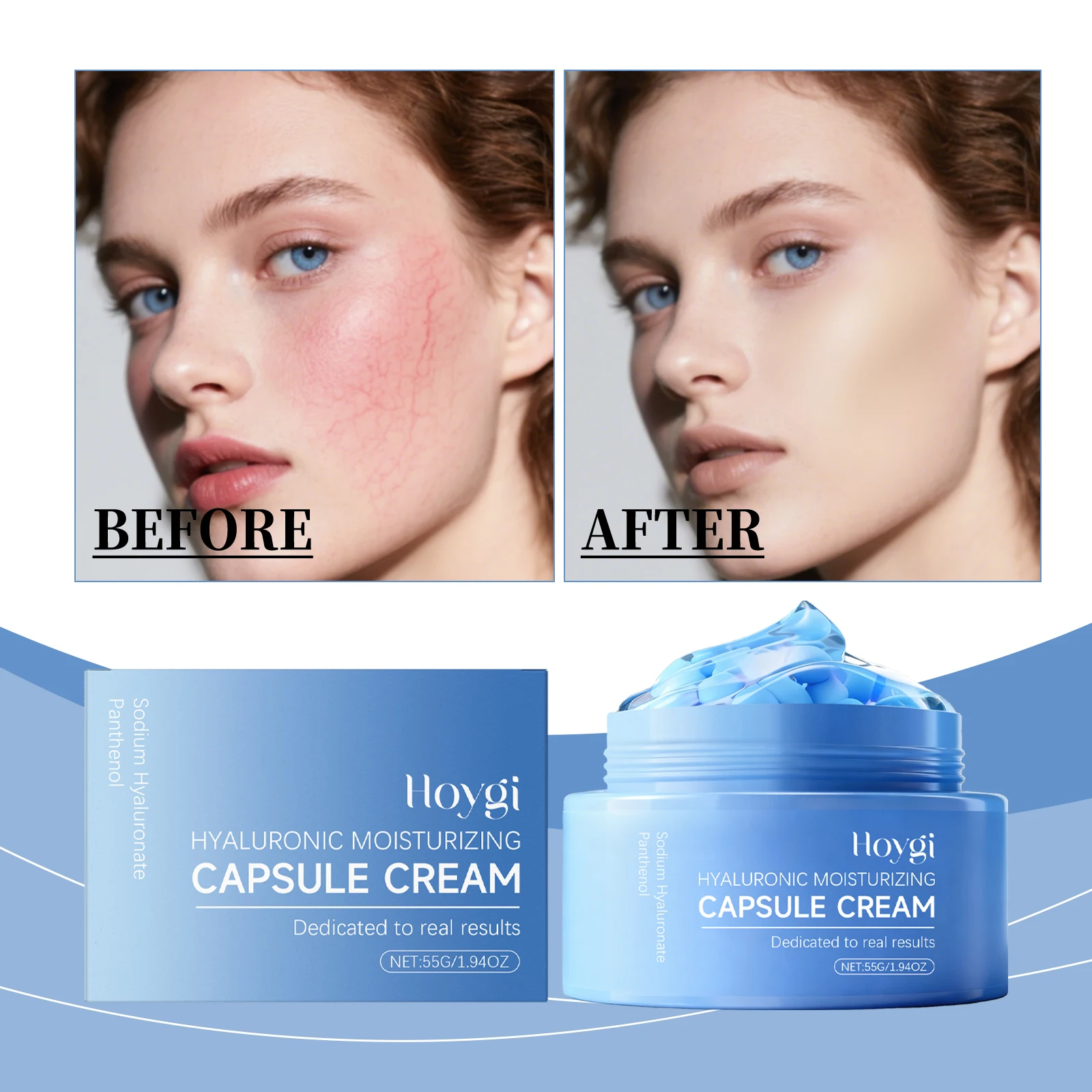 ホイギ ヒアルロン酸保湿カプセルクリーム - 毎日のスキンケアのための保湿フェイスクリーム、軽量処方。
