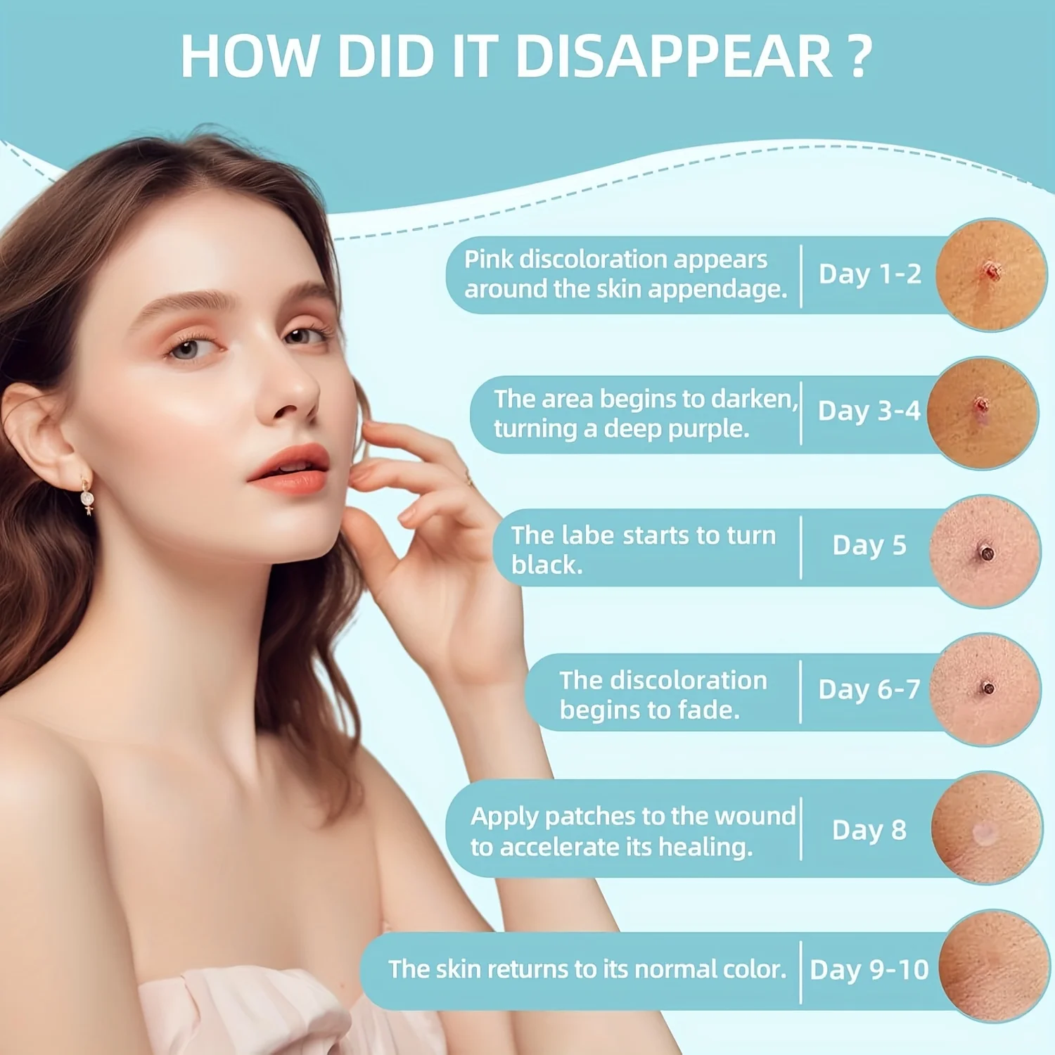 Kit d'élimination 1/2/4 pièces pour les soins de la peau, conception conviviale à une main, sûr et efficace pour un usage domestique