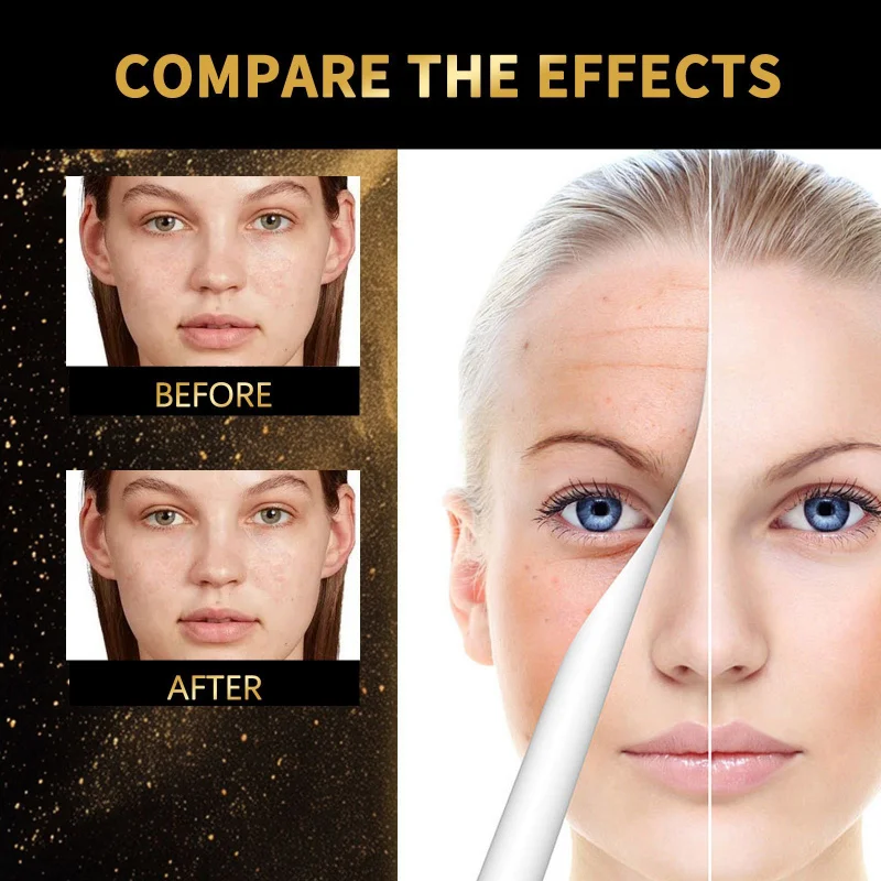 

Увлажняющая увлажняющая отшелушивающая сыворотка удаляет омертвевшую кожу, обеспечивает интенсивное увлажнение и улучшает разглаживание кожи.