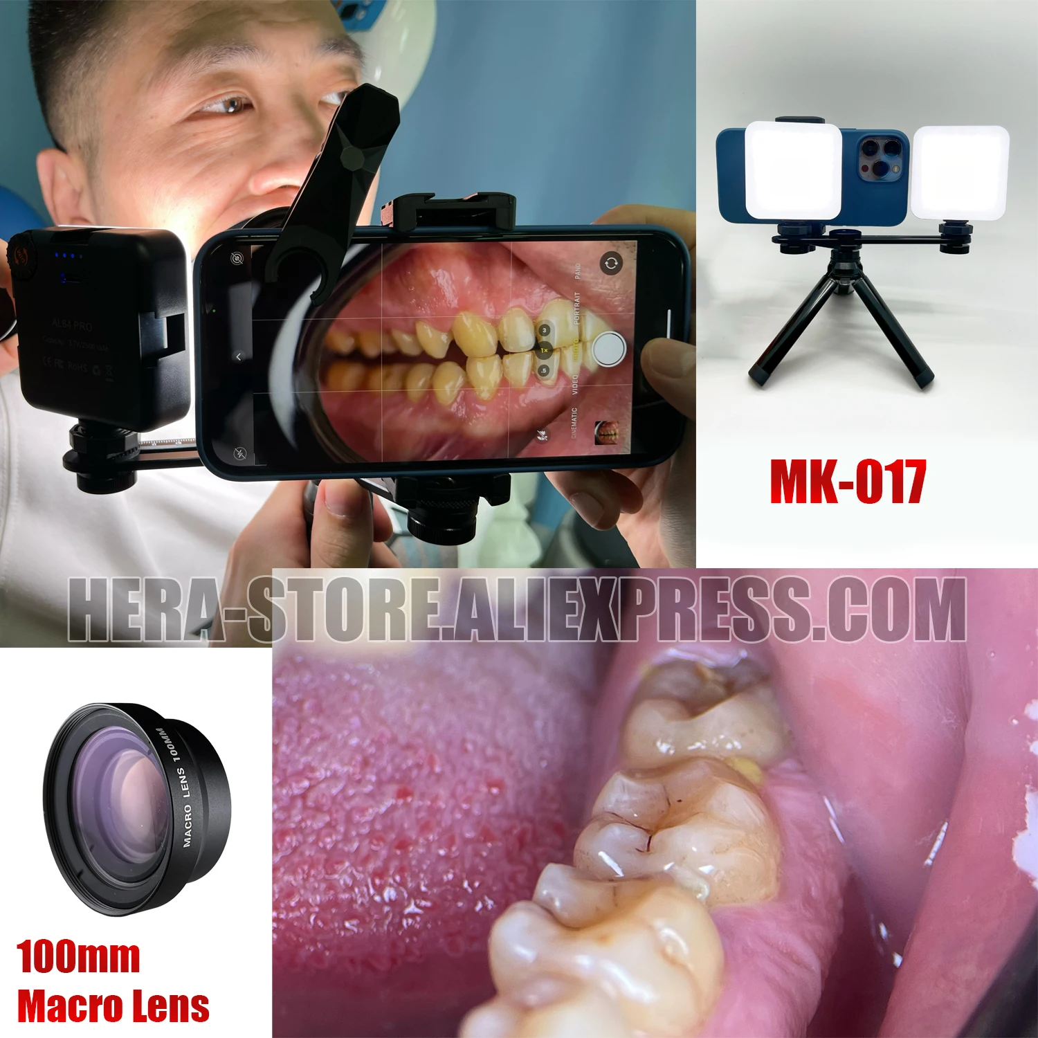 Imagem -03 - Luz de Fotografia Dentária com Bluetooth e Tripé Luz de Enchimento Oral para Tratamento de Odontologia para Dentistas Lâmpada Fotográfica Dentária. Mk17