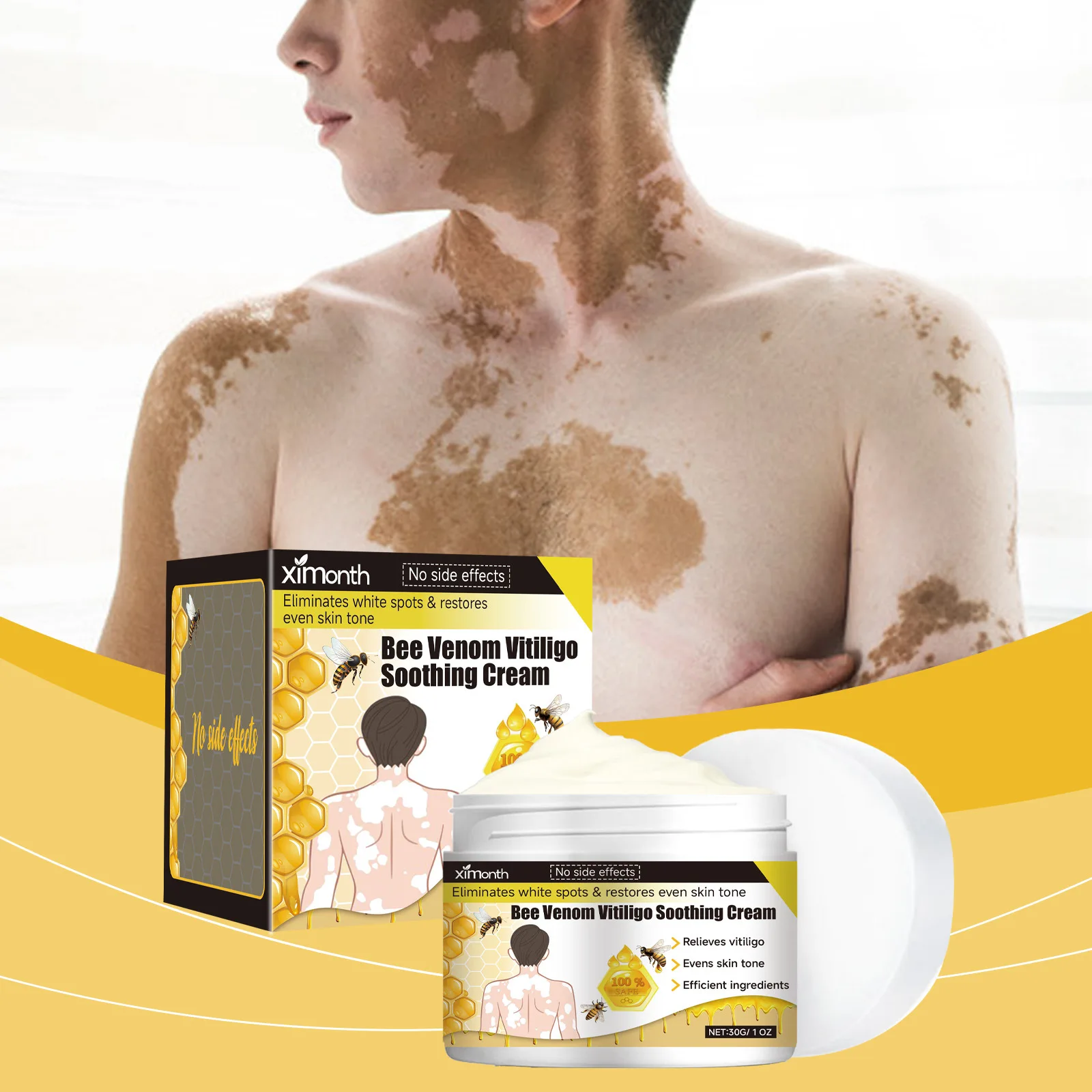 

엄지발가락교정기 Bee Venom Vitiligo Soothing Cream Repair Leukoplakia Reduce Pigment Evens Skin Tone Gentle Moisturizing Easy Absorption