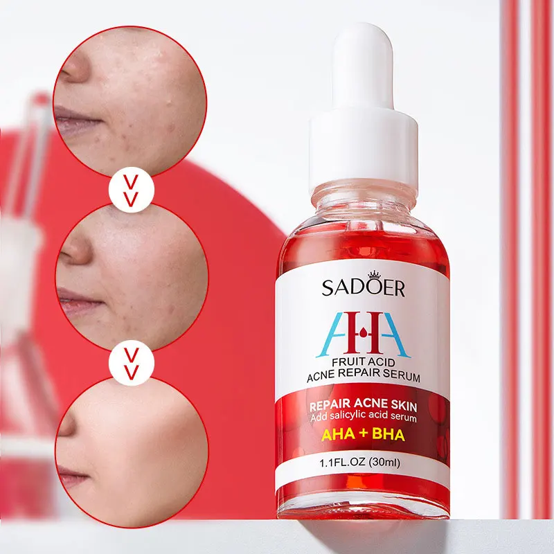 

SADOER Fruit Acid Acne Removal and Repair Serum Skin Care Moisturizing Acne Scars Anti-acne Relief Skin Care