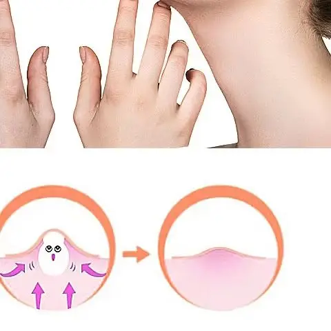 Parche colorido para el acné, pegatina para el cuidado de la piel, corrector, herramienta de maquillaje de belleza para manchas faciales