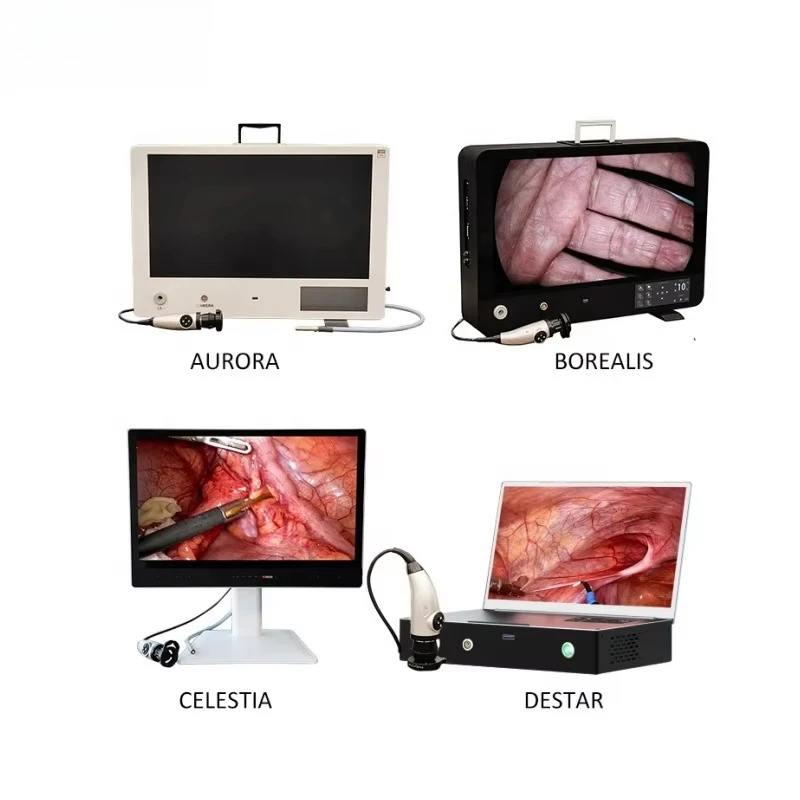 Laptop-mounted veterinary endoscopic  system for human and animal surgery with full high definition  CMOS sensor