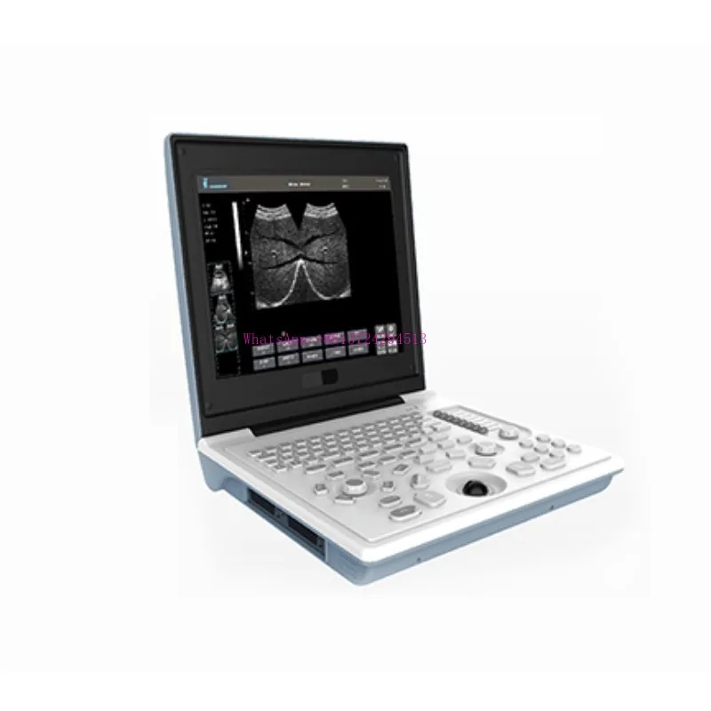 

Full Digital LED Professional laptop type black white ultrasound scanner with good price