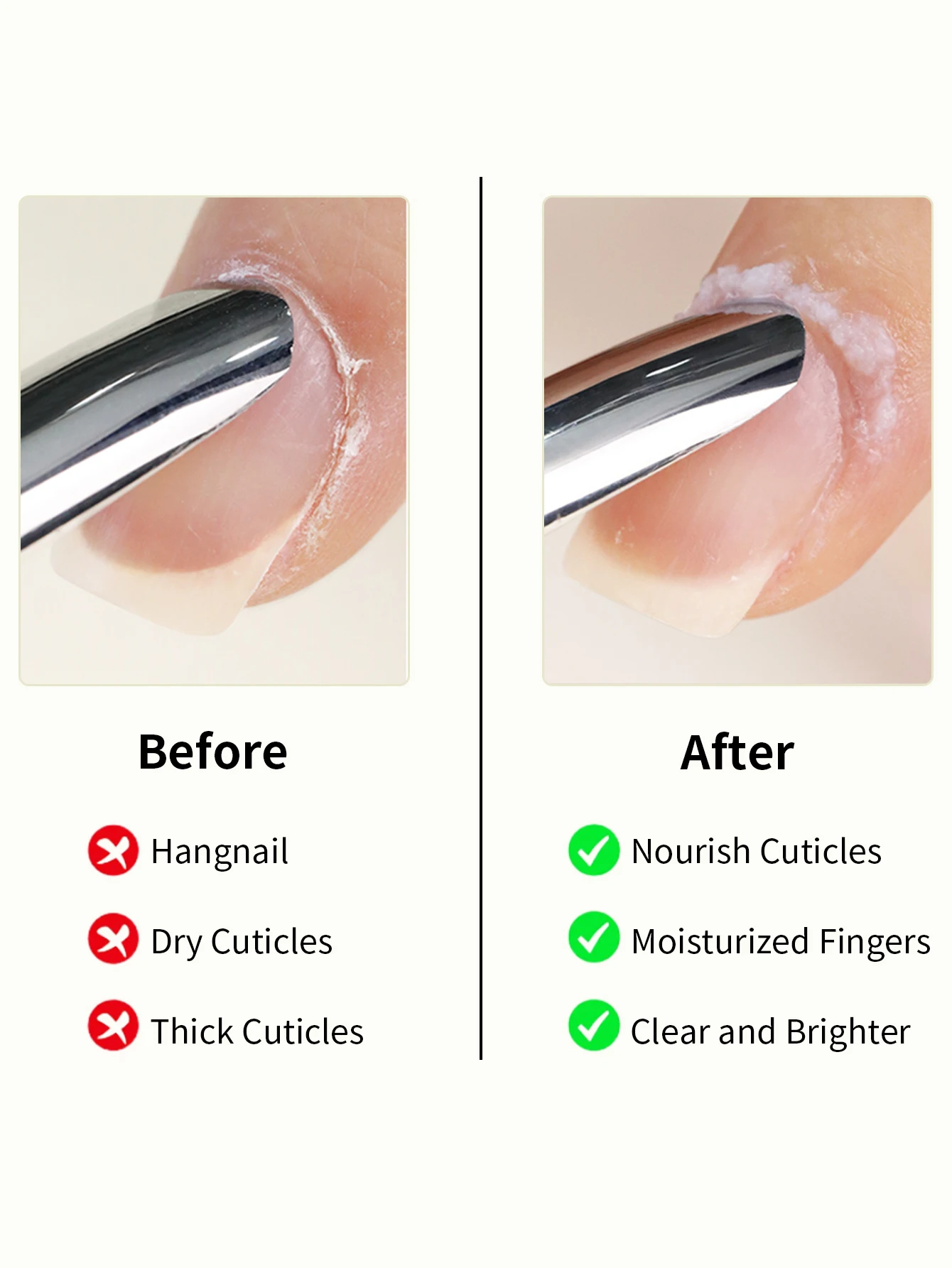 น้ำมันบำรุงเล็บ RS 25 มล. น้ำยาล้างหนังกำพร้า ซ่อมแซมและทำให้หนังกำพร้าอ่อนนุ่ม ชุดดูแลเล็บครบวงจรเพื่อเล็บที่แข็งแรง