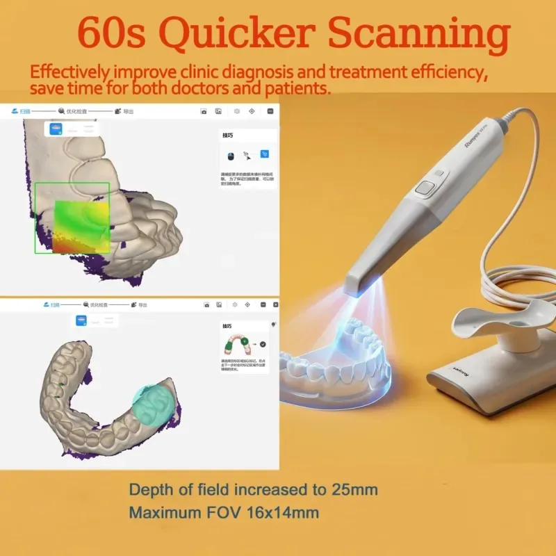 Intraoral Scanner Runyes V5 Pro 60s Quick Impression Scanning AI Scan Ture Color Portable Intra Oral 3D Intraoral