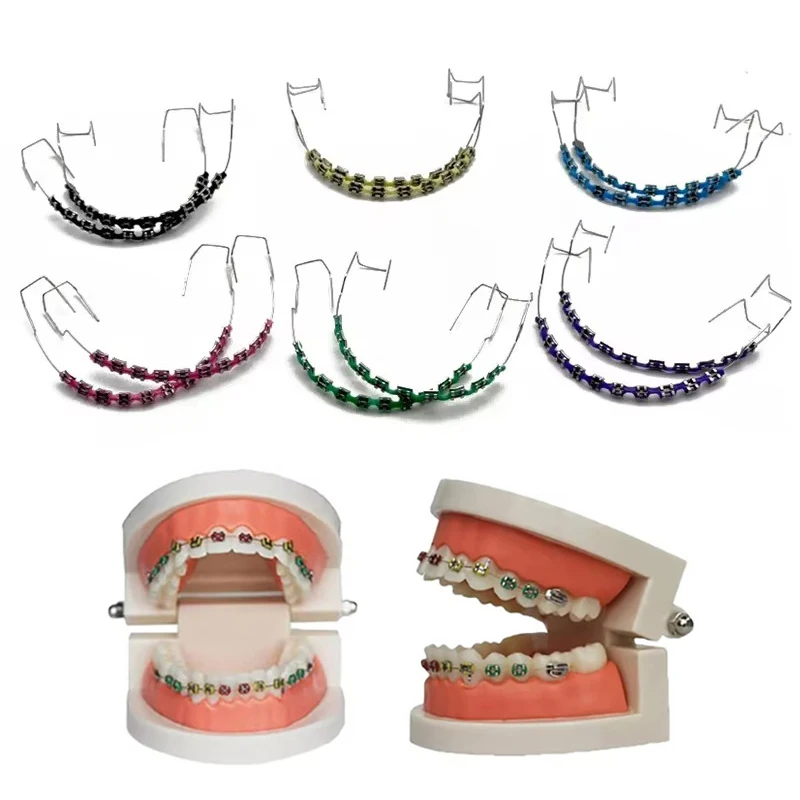 Gefälschte Zahnspangen, bunte Dental-Metalldrähte, temporäre Zähne, Schmuck für Teenager und Erwachsene, sicheres Zubehör in kieferorthopädischer Qualität