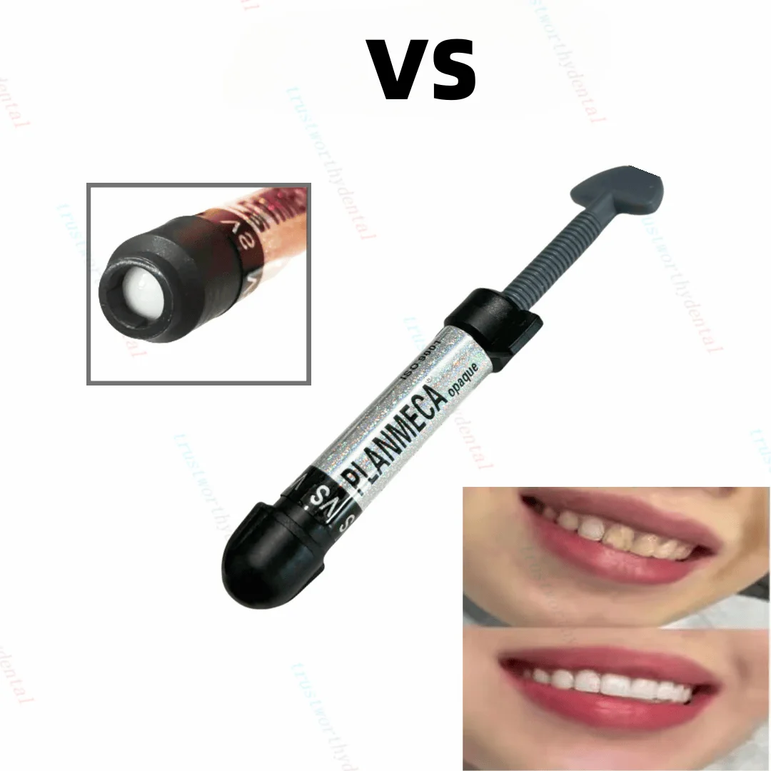 Super Bright White VS Dental Veneer Composite Resin Veneer Hybrid Aesthetic Quality  Brightening Smiles Safe and Reliable Usage