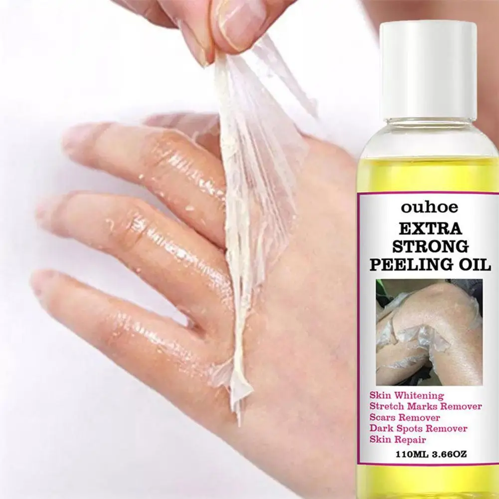 30ML Extra Strong Yellow Peeling Oil Whitening Lighten Care Skin Even Elbows Whiten Skin Hands Knees Tone E7X0