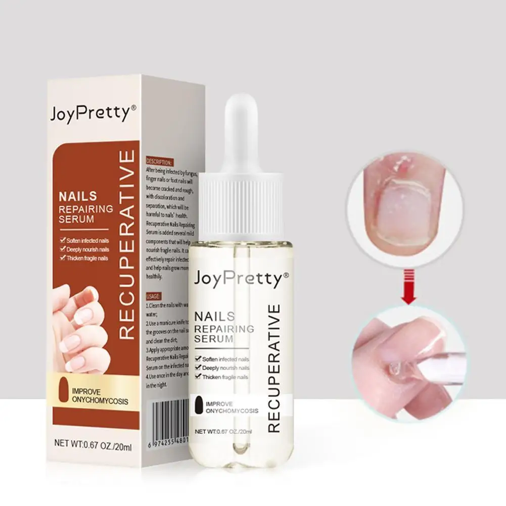 20ml Repairing Serum Nails Repairing Serum From Nourishing Nail Nails Serums 7 Day Protects Discoloration Toenail T5G4