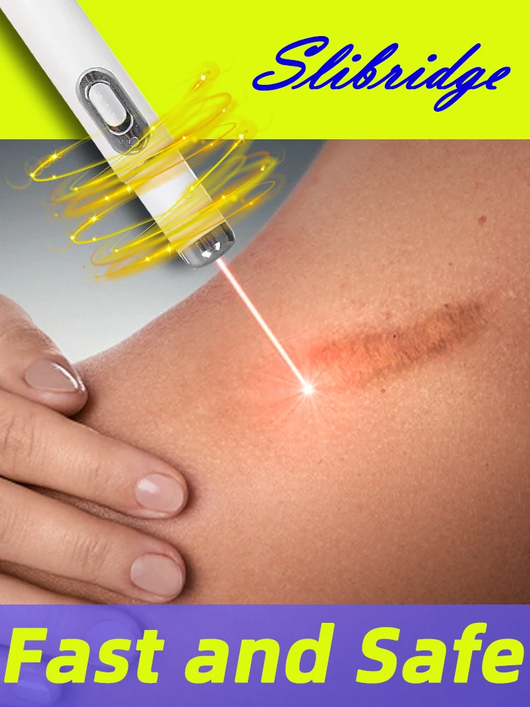 Laser therapy Keloid scar