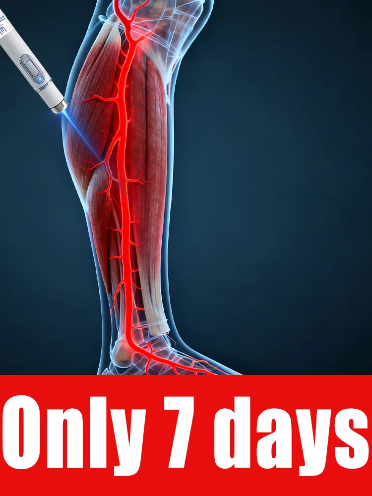 

Vᴀʀɪᴄᴏsᴇ ᴠᴇɪɴ ʟᴀsᴇʀ ɪɴsᴛʀᴜᴍᴇɴᴛ