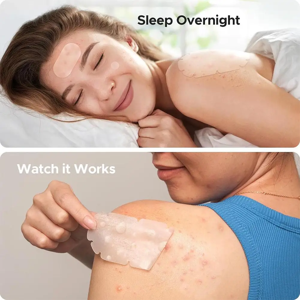 Large Pimple Patches Bulk For Face Hydrocolloid Multi-shape Invisible Removal Acne Patches Covering Body Forehead Chin Blemishes