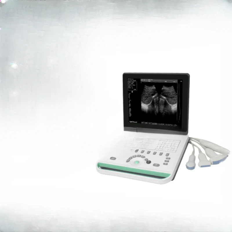 

B-ultrasound medical pregnant woman workstation beauty salon SS-7