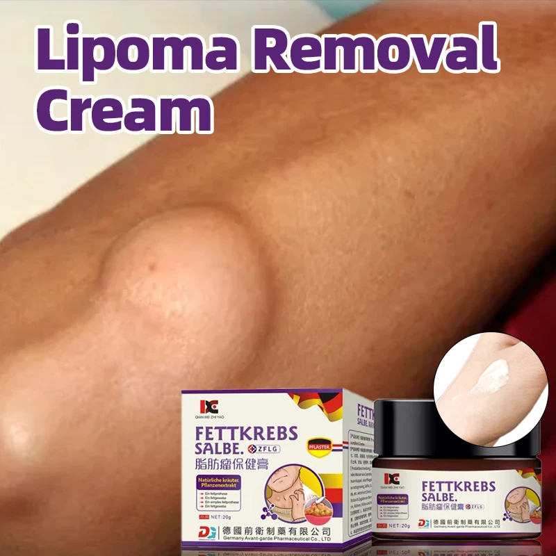 

Lipoma Removal Cream Fat Mass Cellulite Fibroma Remover Patch Fat Lump Lipomas Cyst Treatment Medicine German Secret Recipe