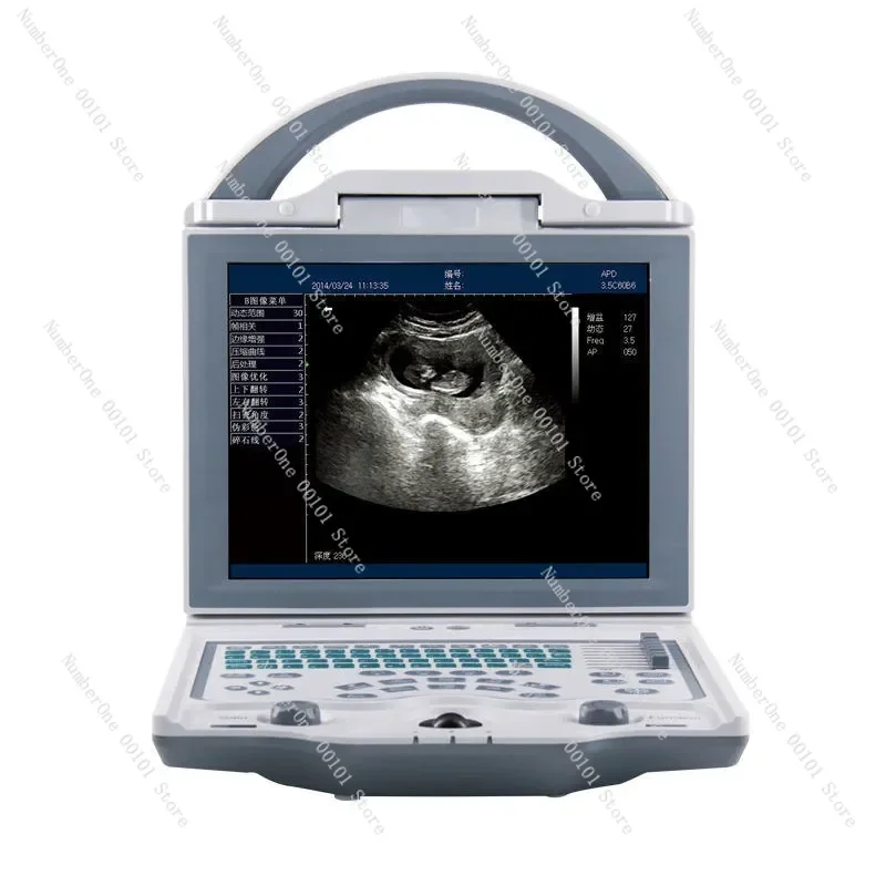 

Dog and Cat Pregnancy Testing Machine LED Screen Laptop Veterinary Ultrasound Scanner Disease Scanner Professional Grade