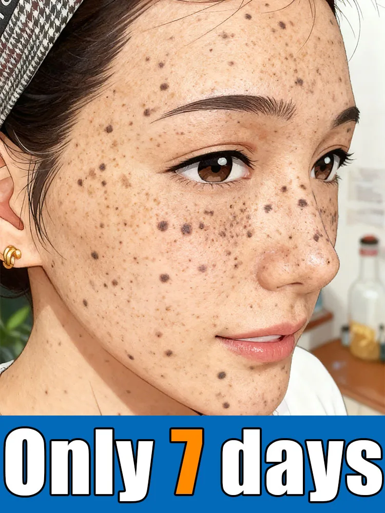 

2025 Горячий продавать второе поколение: попрощайте своим проблем в течение 7 дней, бесплатная доставка