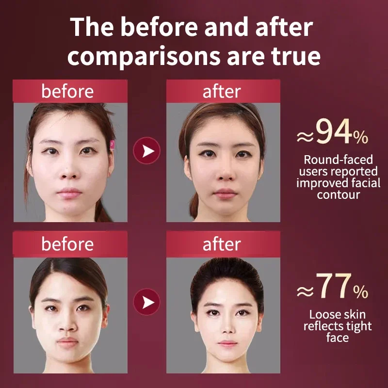 Facial Lifting Device LED Photon Therapy Facial Slimming Vibration Massager Double Chin V Face Shaped Cheek Lift Belt Machine