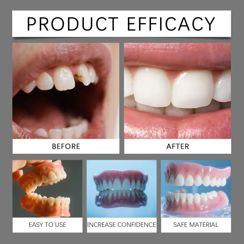 Thumbnail 4 - #80 Latest Denture Adhesives Updates