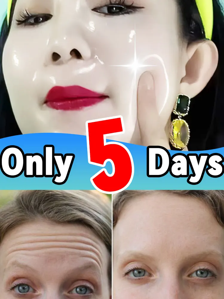 

Younger, Wrinkles Free