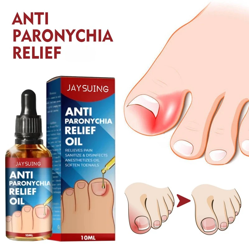 Anti-nail groove relief oil soft nail polish repair ingrown toenails thickening onychomycosis Treatment fungal Infection care