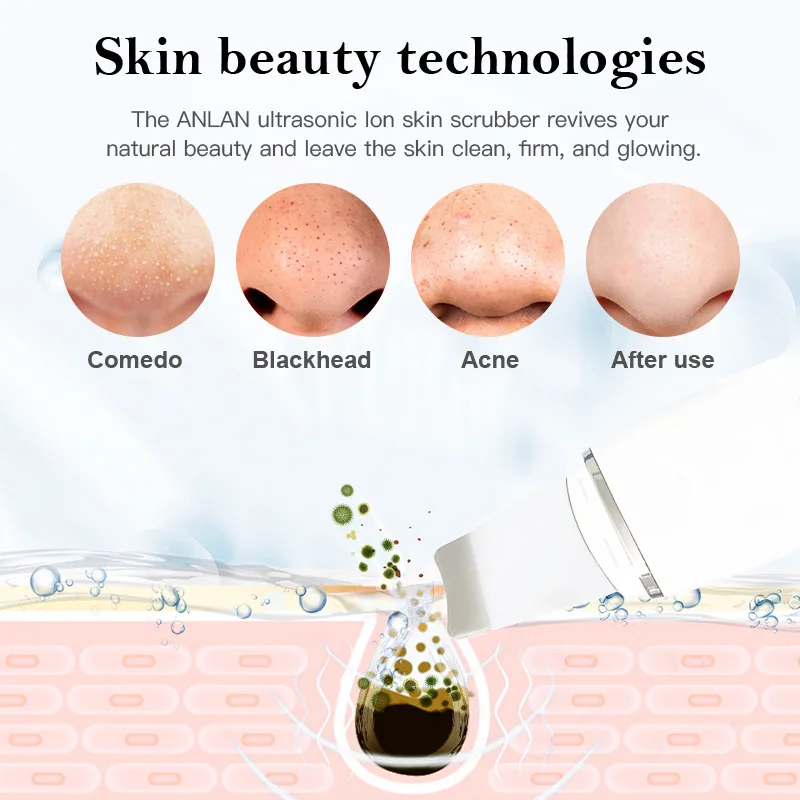 Ultrasonic Skin Scrubber Facial Pore Cleaner Blackhead Remover Ion Shovel Deep Face Cleaning Sonic Peeling Device Skin Care Tool