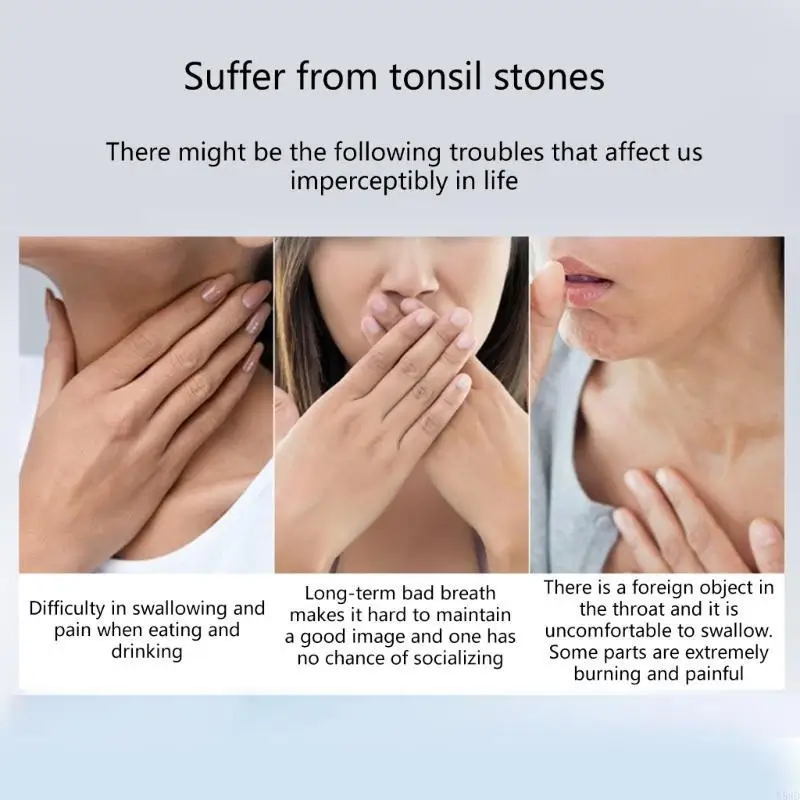 أداة شفط أحجار اللوزتين تتميز بـ 3 مجسات ناعمة و3 شدات شفط N58D #4