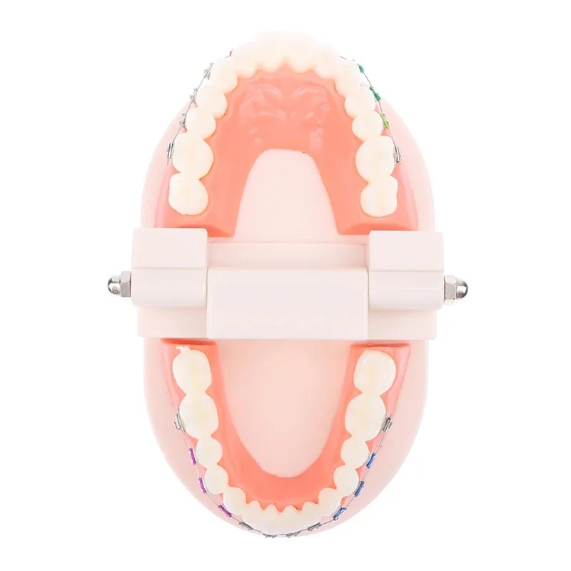 Modelo de tratamiento Dental de ortodoncia, modelo de dientes Typodont para enseñanza, estudio, soportes de Metal/cerámica, lazos de ligadura de alambre de arco, 1 unidad