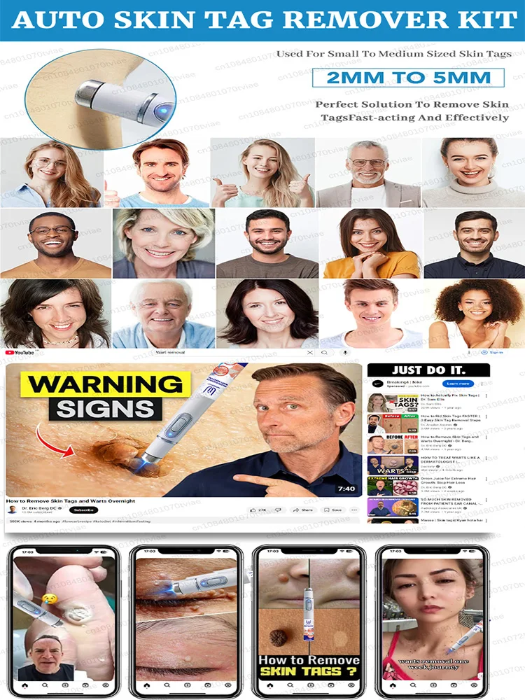 Sᴏʟᴠᴇ sᴋɪɴ ᴘʀᴏʙʟᴇᴍs ᴀɴᴅ ᴏ̨ᴜɪᴄᴋʟʏ ᴇʟɪᴍɪɴᴀᴛᴇ sᴋɪɴ ᴛᴀɢs