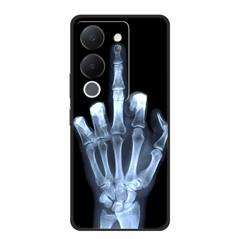 For Vivo V30 Lite Case 6.67\