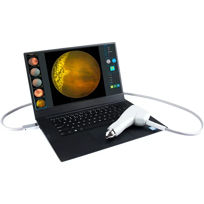 SY-V095 good price Ophthalmic instrument ROP screener wide field   ophthalmic wide field imaging system for pediatric