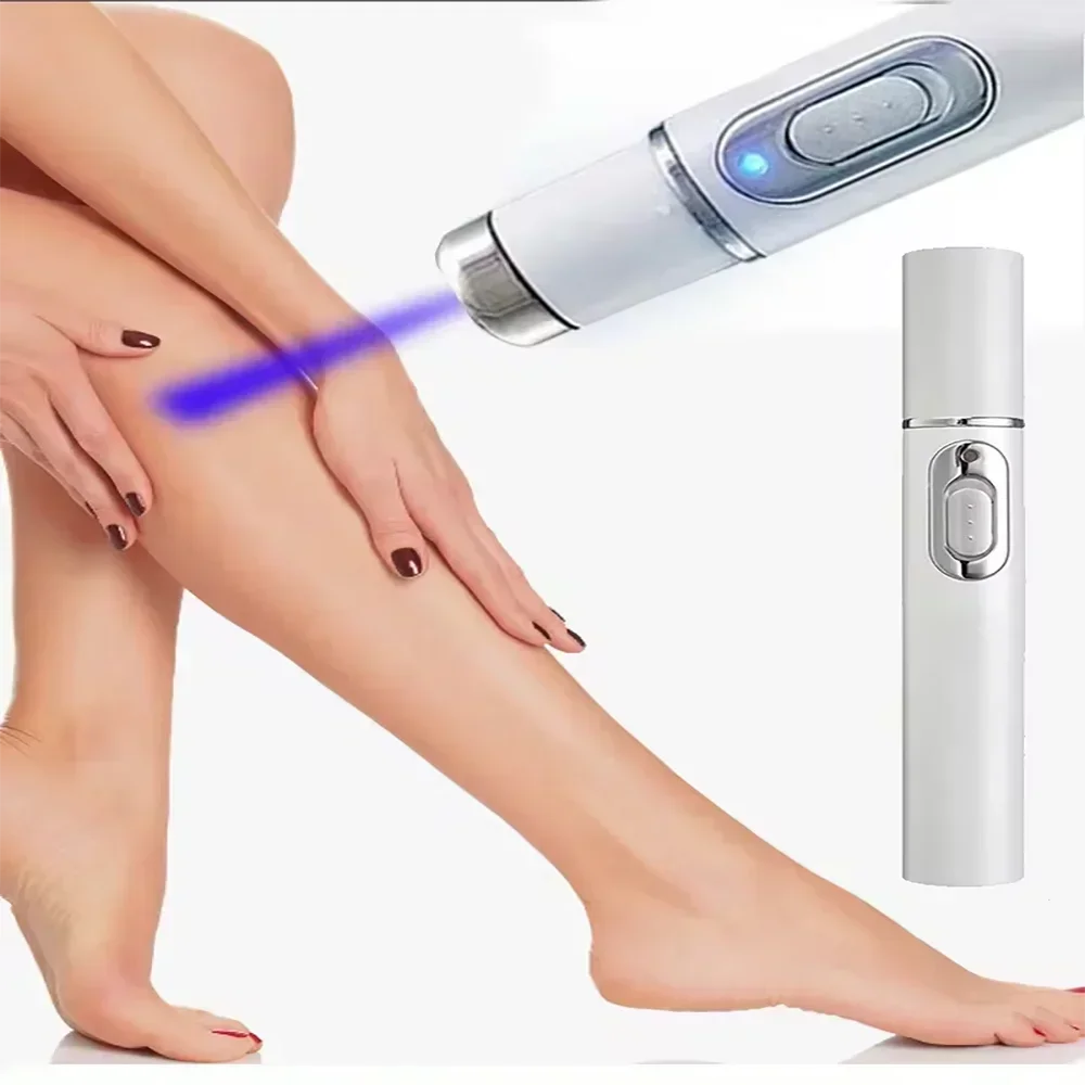 Lampshade Therapy Leg Repair Pen, Relieves Leg Bulge Discomfort Improving Blood Circulation Varicose Veins Pen Skin Care Product