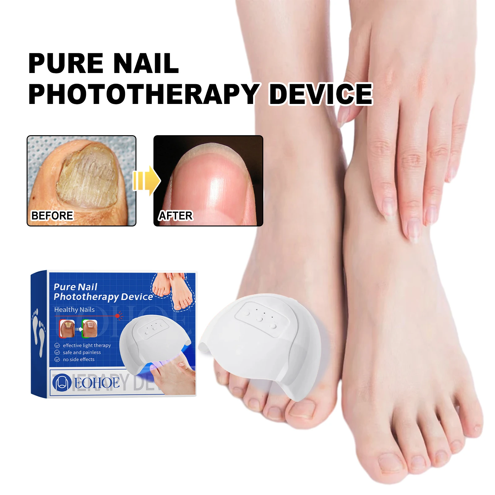 Home Use Nail-Fungus Remover Effective Nail Fungus Laser Therapy Device Nail Fungus Laser Therapy LED Light Device for Toenails