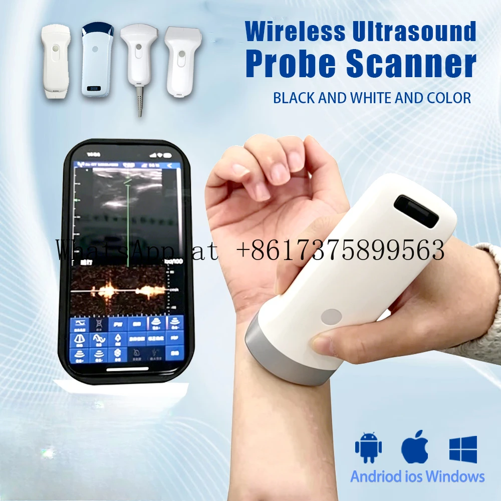 Pet Animal Human Ult rasound Probe Wireless WIFI Dop pler Type Portable Scanner Fit iOS Android Windows