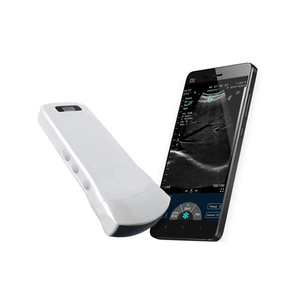 

Wireless Digital Portable Ultrasound Device Wifi Probe Ultrasound Scanner Handheld Animal Sonar Scanner