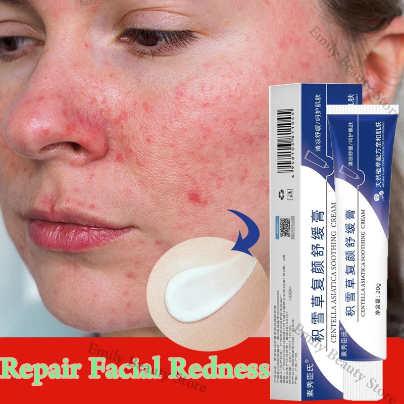 Natural Facial Redness Repair Cream Effective Soothing Red Blood Rosacea Treat Sensitive Skin Sensitive Skin Korean Cosmetics