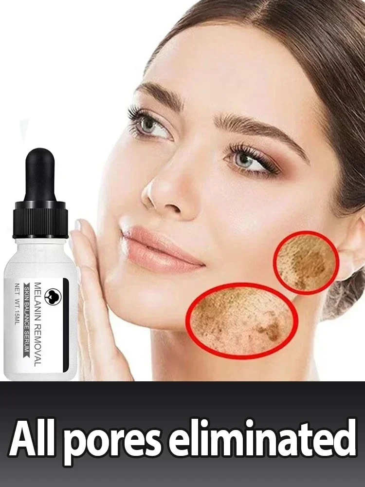 

Niacinamide Dark Spots Remover Serum Freckle Whitening Moisture Powerful Removal Black Dot Melasma Chloasma Face Skin Care Cream