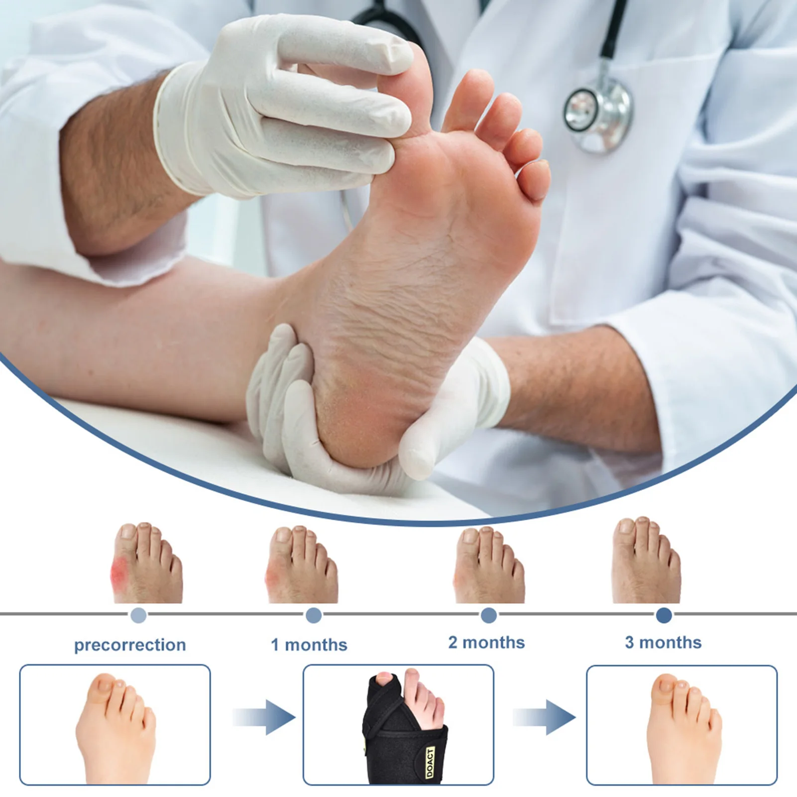 

Not Slide Or Fall Bunion Splints Inside Aluminum Bunion Corrector Return To Natural Alignment for Female Home Adults Male